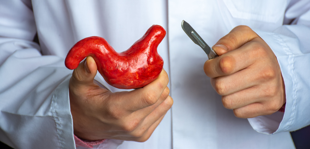 Cirurgia bariátrica: o que ninguém te conta sobre o pós-operatório