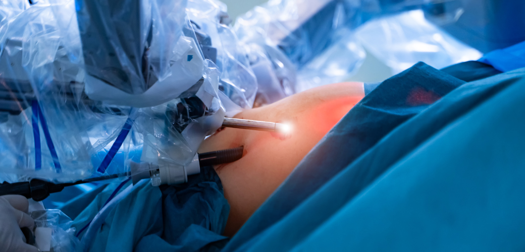 Bariátrica e alimentação: como montar um cardápio equilibrado após a cirurgia